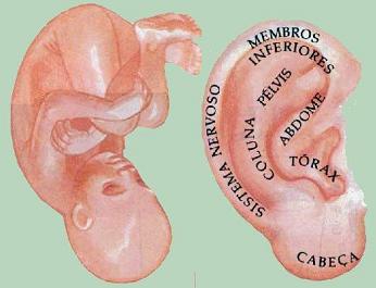 Auriculoterapia