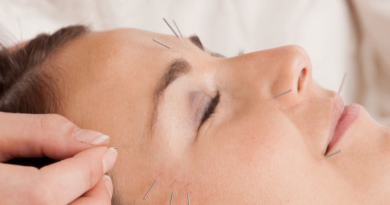 De acne a olheira: veja o que a acupuntura estética é capaz de fazer