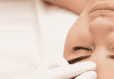 Estudo revela como a acupuntura é eficaz no combate à enxaqueca